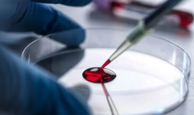 உலகில் ஒரே ஒரு பெண்ணுக்கு மட்டுமே உள்ள அரிய வகை ரத்தம் - வேறு யாரிடமும் ரத்த தானம் பெற முடியாது